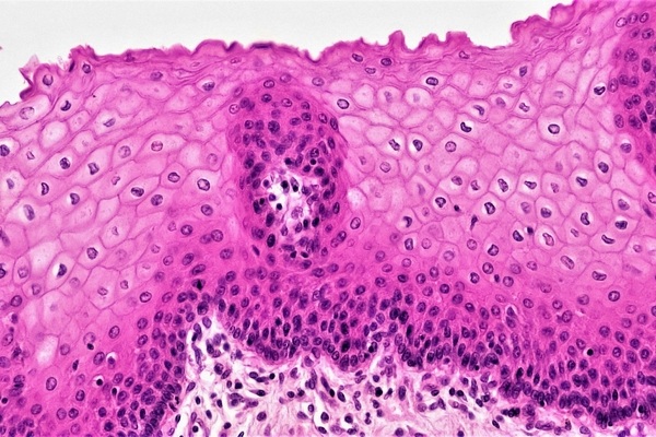 bioscience-image-library-by-fayette-reynolds-GAGetw-WkHs-unsplash (1) (1) Researcher looking at regenerated cells through microscope
