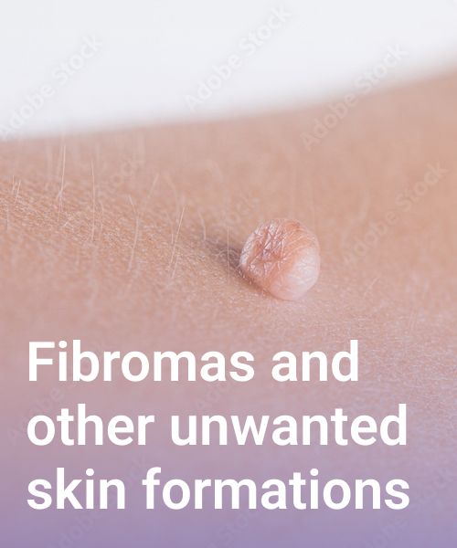 Fibromas and other unwanted skin formations